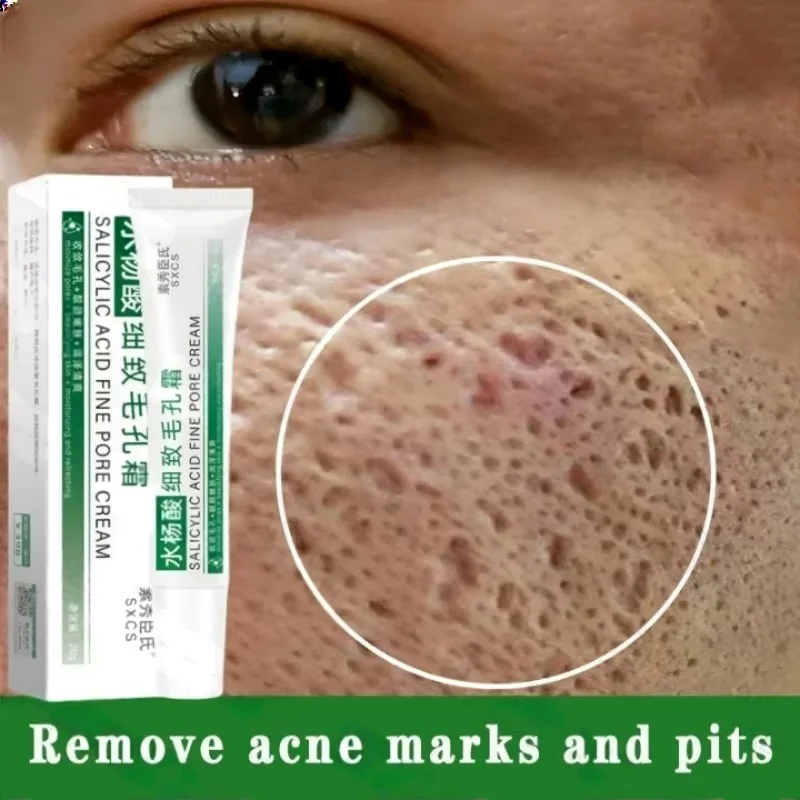 حمض الساليسيليك كريم إزالة الم - مراجعة Collagen Peptide Powder وسعره