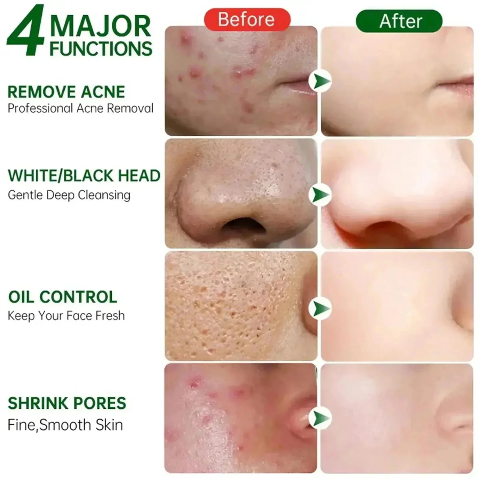 حمض الساليسيليك كريم إزالة الم - مراجعة Collagen Peptide Powder وسعره
